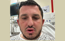 Sittingbourne Man Injured In Medway Acid Attack
